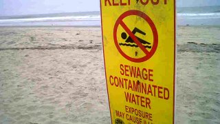 A sign warns beachgoers of contaminated water due to sewage in Imperial Beach in this undated photo.