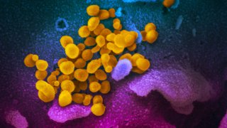 The SARS-CoV-2, the virus that causes COVID-19, or the coronavirus, as seen in this image emerging from lab grown cells. The virus was isolated from a patient from the United States.