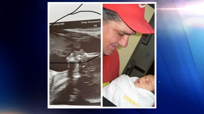 side by side ultrasound and chuch carrillo