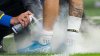 Qué es el spray mágico que se usa en el fútbol para las lesiones