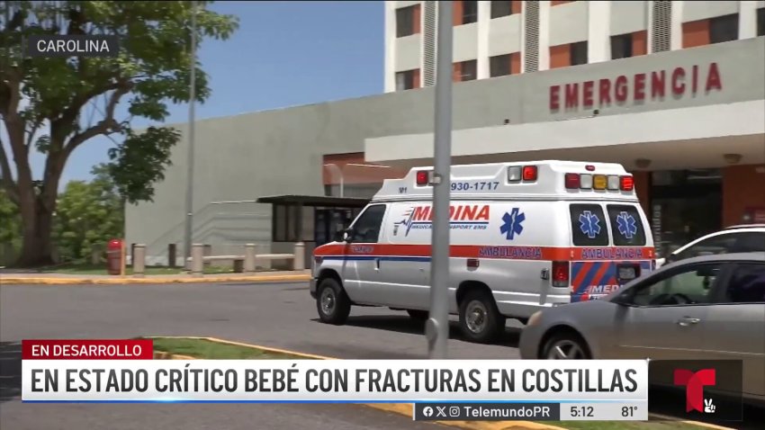 Hallan toalla desechable en garganta de bebé de 3 meses